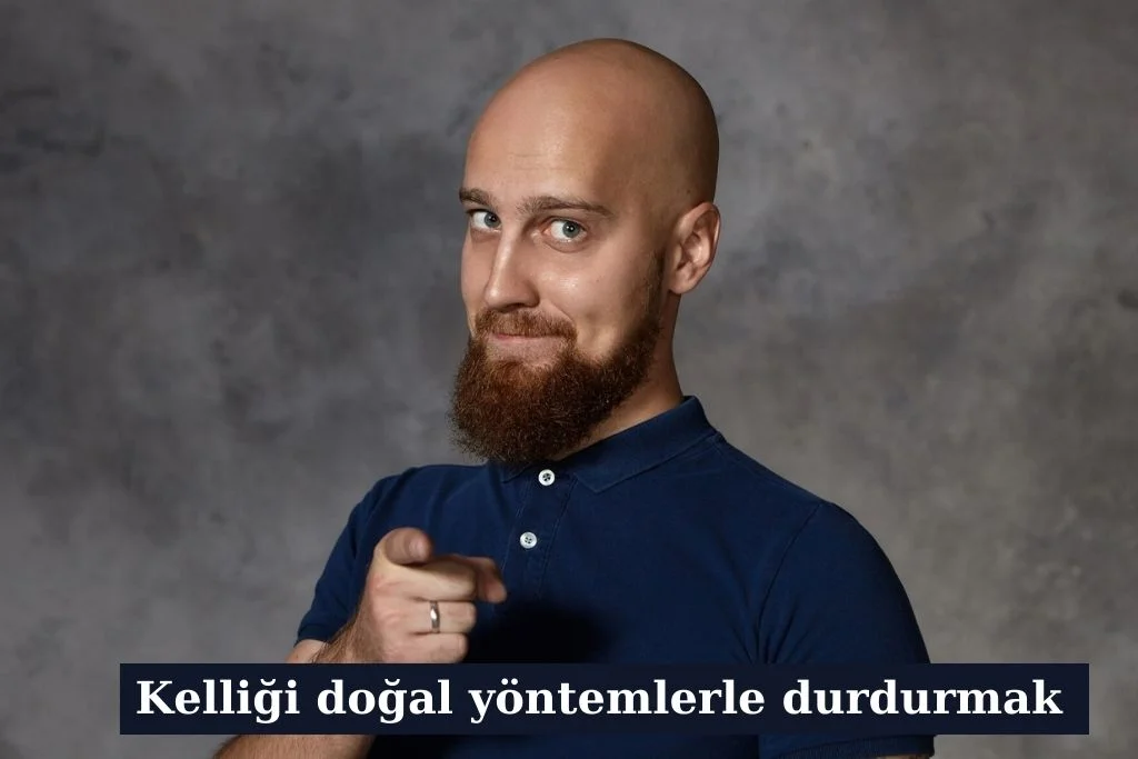 Kelliği Doğal Yöntemlerle Durdurmak Için Neler Yapılmalı Kelliği Doğal Yöntemlerle Durdurmak