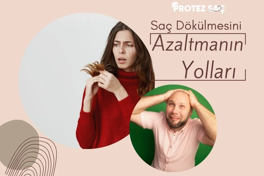 Saç Dökülmesini Azaltmanın Yolları Nelerdir   Protezsactr Saç Dökülmesini Azaltmanın Yolları Nelerdir