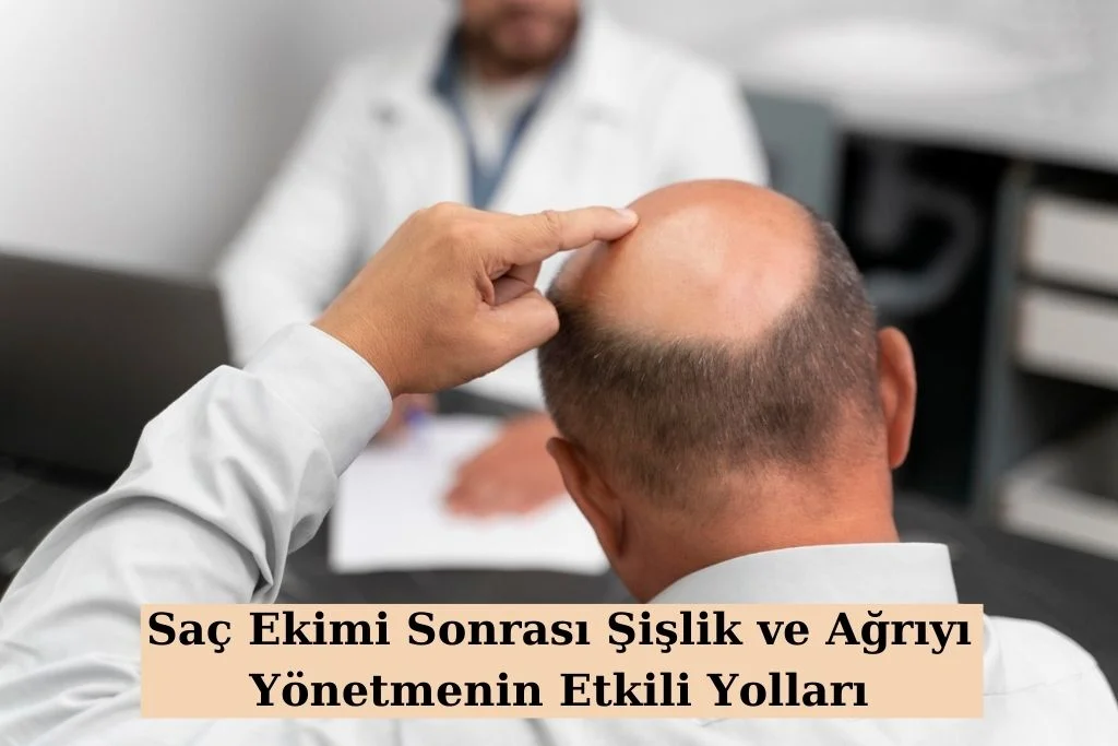 Saç Ekimi Sonrası Şişlik Ve Ağrıyı Yönetmenin Etkili Yolları   Protez Saç Saç Ekimi Sonrası şişlik